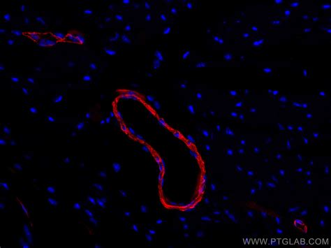 smooth muscle actin antibody (CL594-14395) | Proteintech