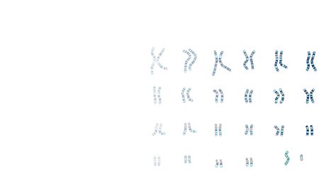 Xo Karyotype