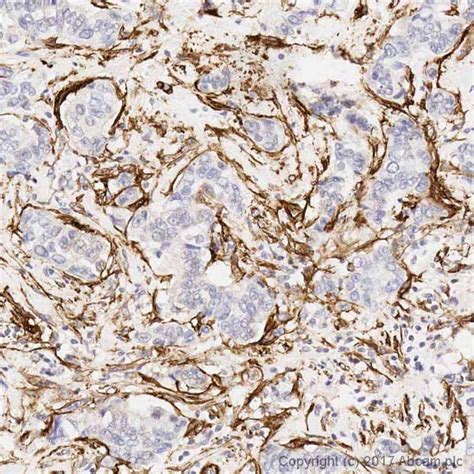 Anti-alpha smooth muscle Actin antibody [1A4] KO Tested (ab7817) | Abcam