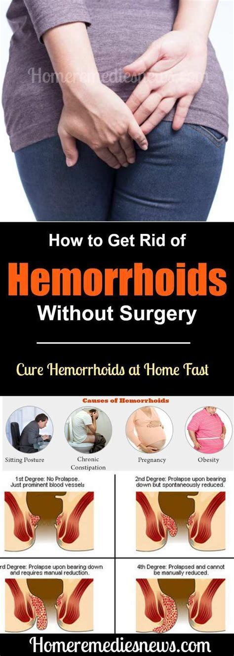 How to Get Rid of Hemorrhoids Without Surgery | Home remedies for ...