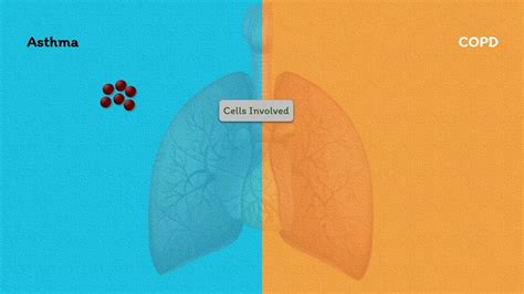 Asthma vs COPD | Pathophysiology | Exam Tips for Students