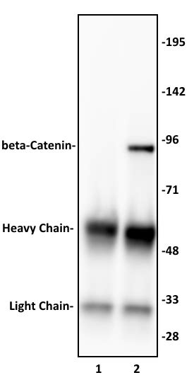 beta-Catenin antibody (pAb) - United Bio Research