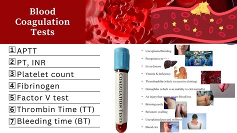 Coagulation Tests Purpose, Procedure, Normal Values and Interpretation ...