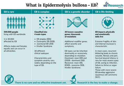 What is EB? - EB-Research