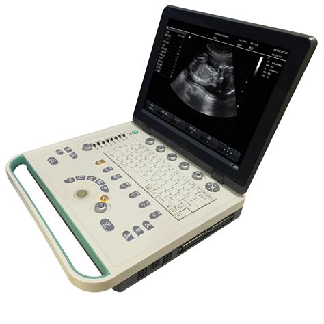 Medical Ultrasound Instruments Portable Color Doppler Digital ...