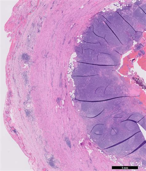 Appendix Histology