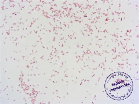 Morganella Morganii Gram Stain