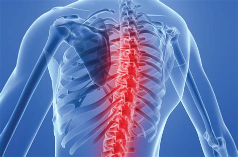 Understanding spinal cord lesions in progressive MS - MS Australia