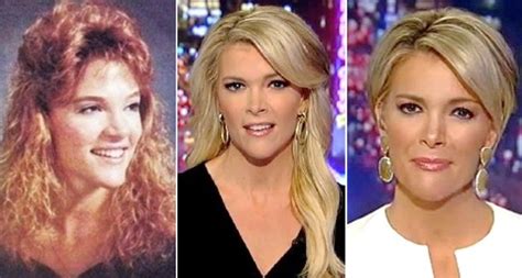 SG megyn kelly nose job plastic surgery haircut