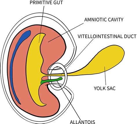 Omphalomesenteric Cyst