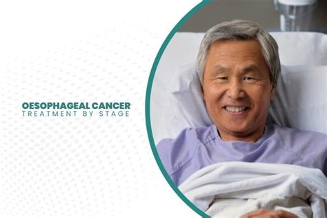 Oesophageal Cancer Treatment by Stage | Nexus Surgical