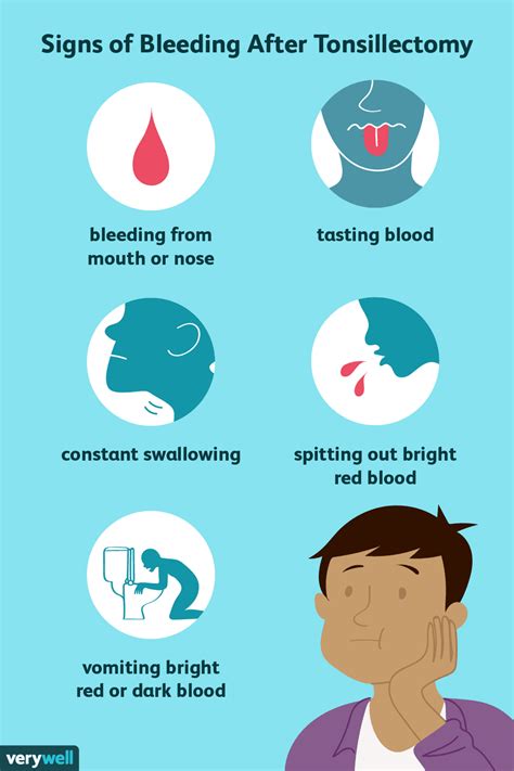 Bleeding After a Tonsillectomy