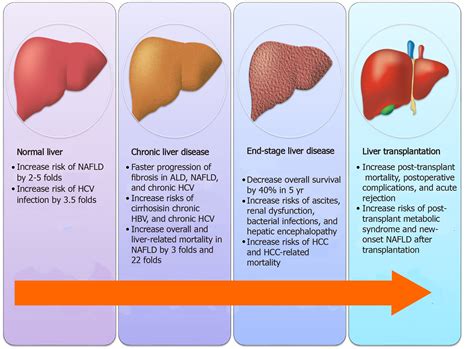 Clinical implications, diagnosis, and management of diabetes in patients with chronic liver diseases