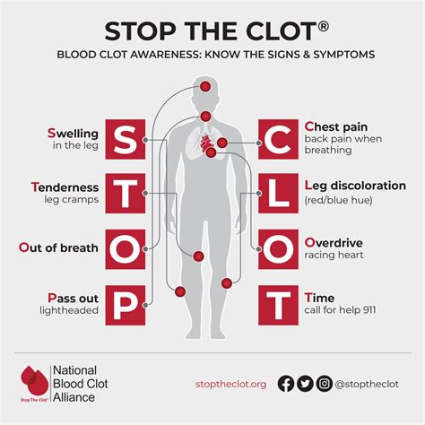 New Blood Clot Awareness Stop the Clot® Acronym - Blood Clots