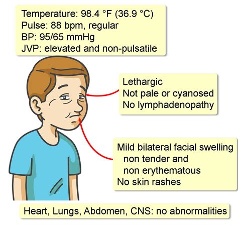 Vena Cava Syndrome