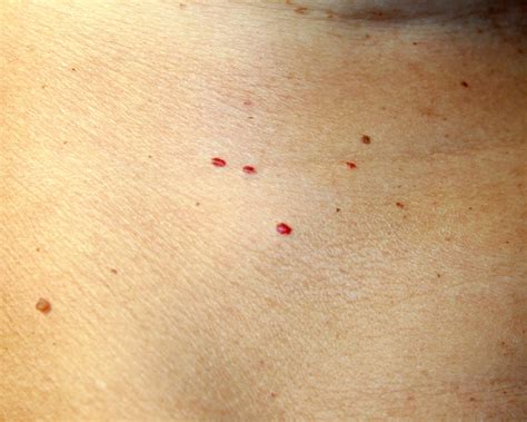 7 Causes of Red Spots and Bumps on Skin, With Pictures | Allure