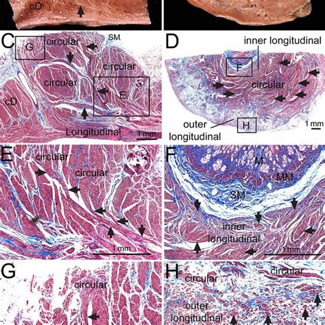 Histological examinations of the pyloric sphincter (PS) with the... | Download Scientific Diagram