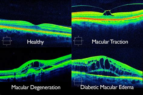 Comprehensive Eye Exam | Eyes and Vision Optometrists | Book Online Now