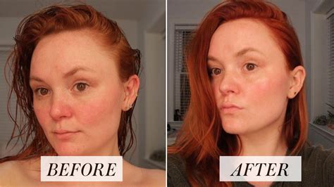 I Tried a Japanese Skin-Care Routine for a Month: Before & After Photos | Allure