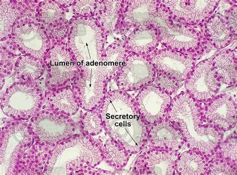 Rabbit. Mammary gland. 125X - Animals - Mammals - Integumentary system ...