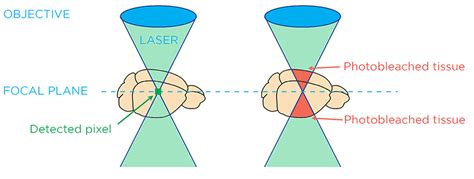 Light Sheet vs. Confocal Microscopy for 3D Imaging