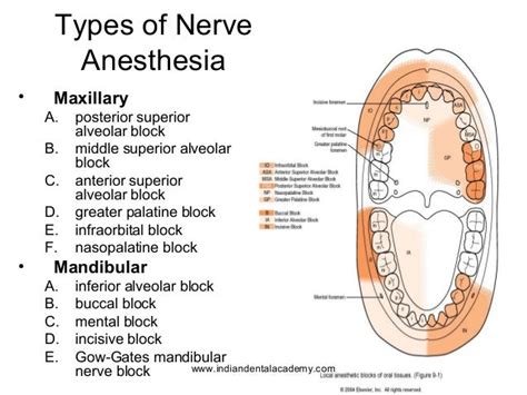 types of local anesthesia - pictures, photos