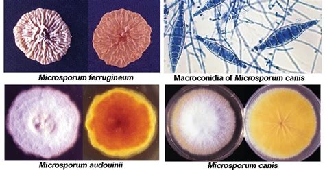 Microsporum spp- An Overview