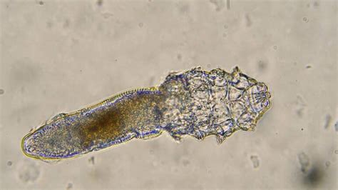 Demodex Mites Under The Microscope - Ungex | Demodex treatment