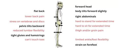 pilates exercises for flat back posture Archives - SAMARPAN PHYSIOTHERAPY CLINIC AHMEDABAD