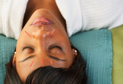 Acupuncture Techniques for Treating Acne, Eczema, Psoriasis