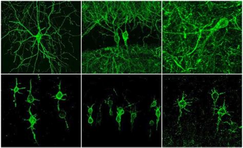 Fluorescent Brain Probe Visualizes Groups of Neurons As They Compute