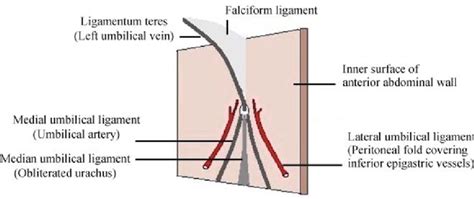 Urachus Median Umbilical Ligament