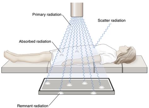 What Is Primary Beam Radiation - The Best Picture Of Beam