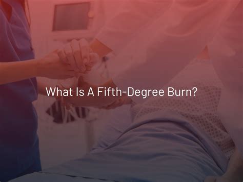 What is a Fifth-Degree Burn?