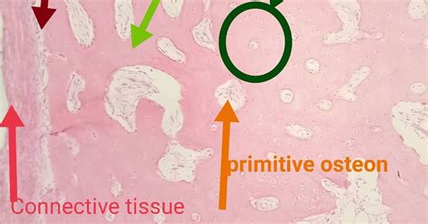 Cancellous/Spongy Bone Histology Slide Identification Points