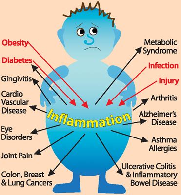 Food ingredients can help prevent chronic inflammation