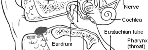 Boil (Furuncle) In The Ear Canal , ENT Consultant London MR Kiran Jumani - Ear nose and throat ...