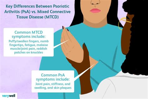 Risk Factors And Precautions For Connective Tissue Disease - Ask The Nurse Expert