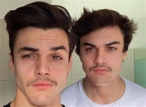 What Happened to the Dolan Twins' Noses? Did They Go Under the Knife?