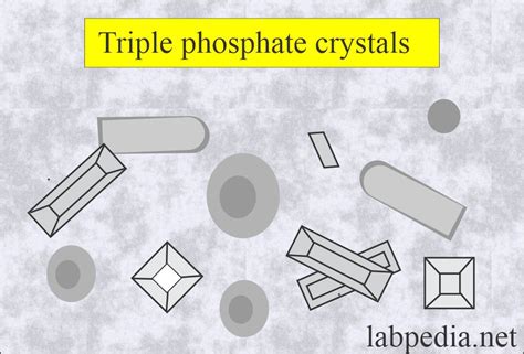 Triple Phosphate Crystals In Human Urine