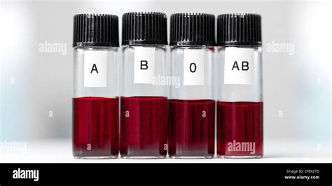 samples with the various blood types Stock Photo - Alamy