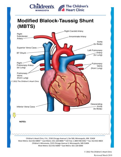 Modified Blalock-Taussig Shunt Procedure - DocsLib