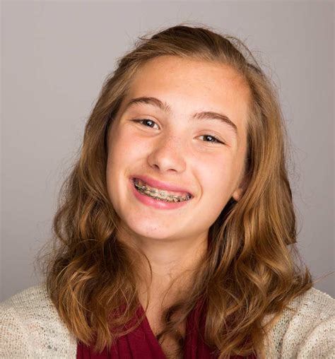 Braces for Teens | Orthodontist Ottawa ON | Centrepointe Orthodontics