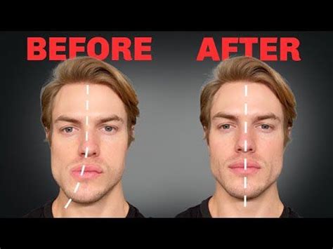 How to Fix Asymmetrical Jaw & Face (FOREVER) - YouTube | Jawline ...