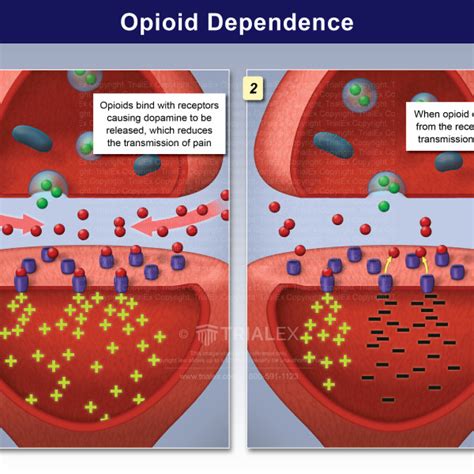 Opioid Dependence - TrialExhibits Inc.