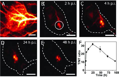 In vivo fluorescence imaging of tumor in the NIR-IIb window with a T/NT... | Download Scientific ...