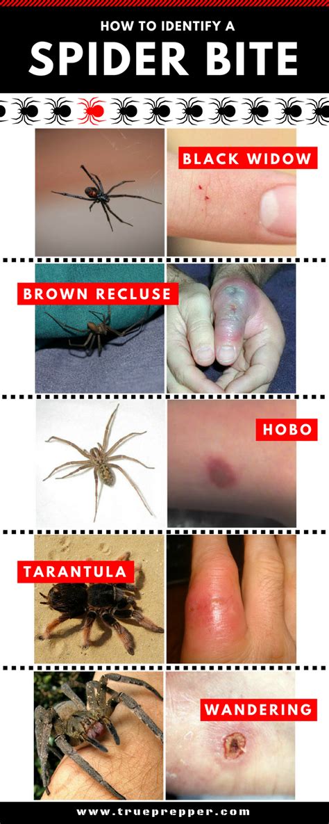 Identify Type Of Spider Bite