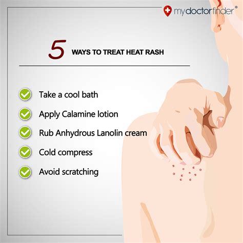 5 Ways to Treat Heat Rash