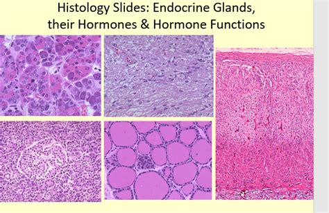 Solved Histology Slides: Endocrine Glands, their Hormones \& | Chegg.com