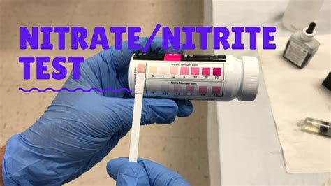 Nitrate-Nitrite Test - YouTube